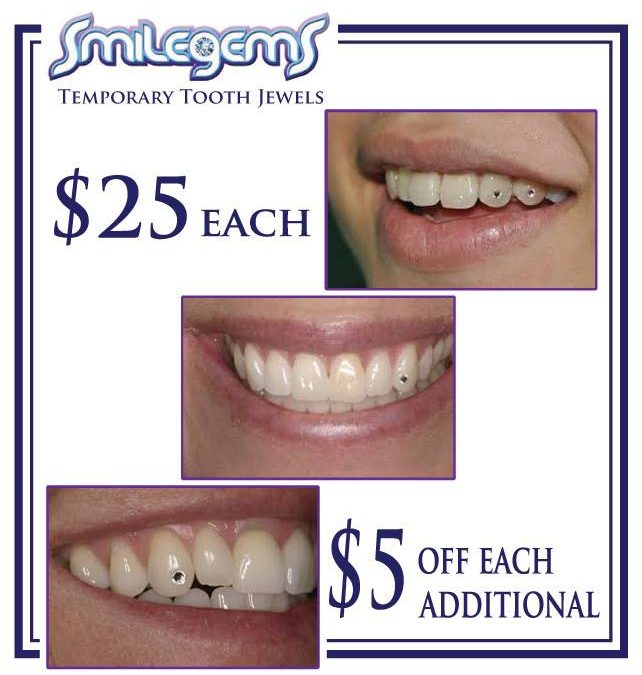 Now Offering Smilegems at Our Sterling Heights Location